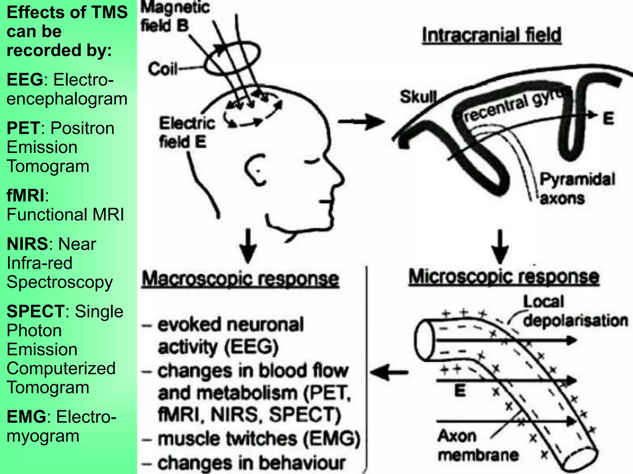 Effects of TMS
can be
recorded by:
EEG: Electro-
encephalogram
PET: Positron
Emission
Tomogram
fMRI:
Functional MRI
NIRS: Near
Infra-red
Spectroscopy
SPECT: Single
Photon
Emission
Computerized
Tomogram
EMG: Electro-
myogram
 