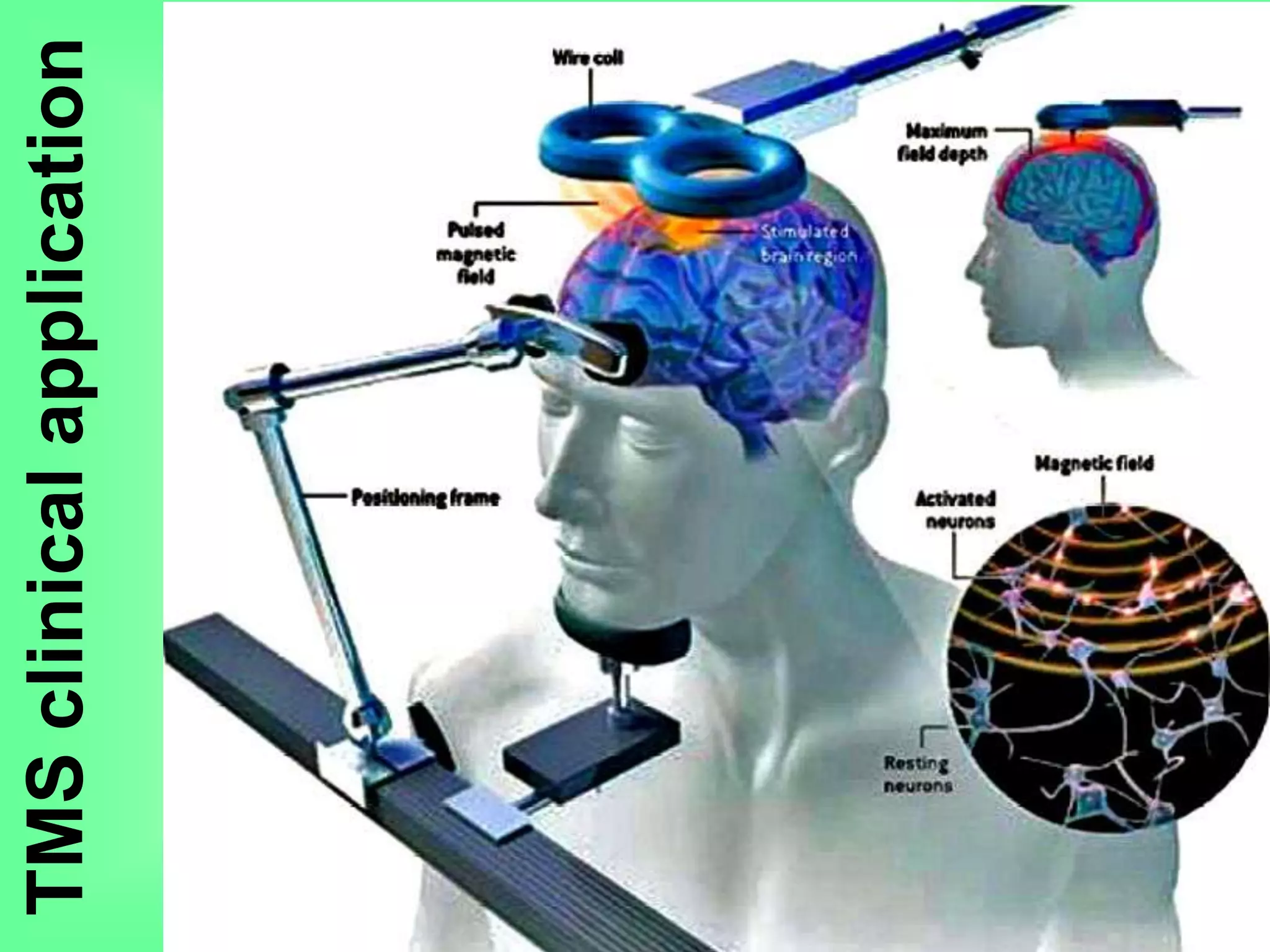TMSclinicalapplication
 