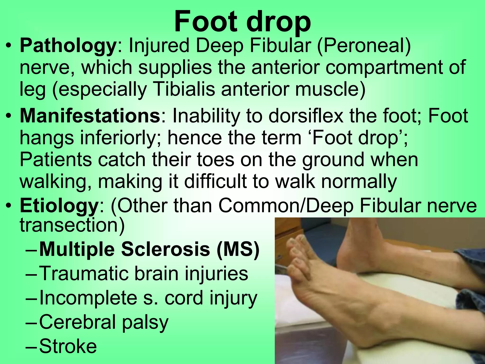 • Pathology: Injured Deep Fibular (Peroneal) nerve,
which supplies the anterior compartment of leg
(especially Tibialis anterior muscle)
• Manifestations: Inability to dorsiflex the foot; Foot
hangs inferiorly; hence the term ‘Foot drop’;
Patients catch their toes on the ground when
walking, making it difficult to walk normally
• Etiology: (Other than Common/Deep Fibular nerve
transection)
–Multiple Sclerosis (MS)
–Traumatic brain injuries
–Incomplete s. cord injury
–Cerebral palsy
–Stroke
Foot drop
 