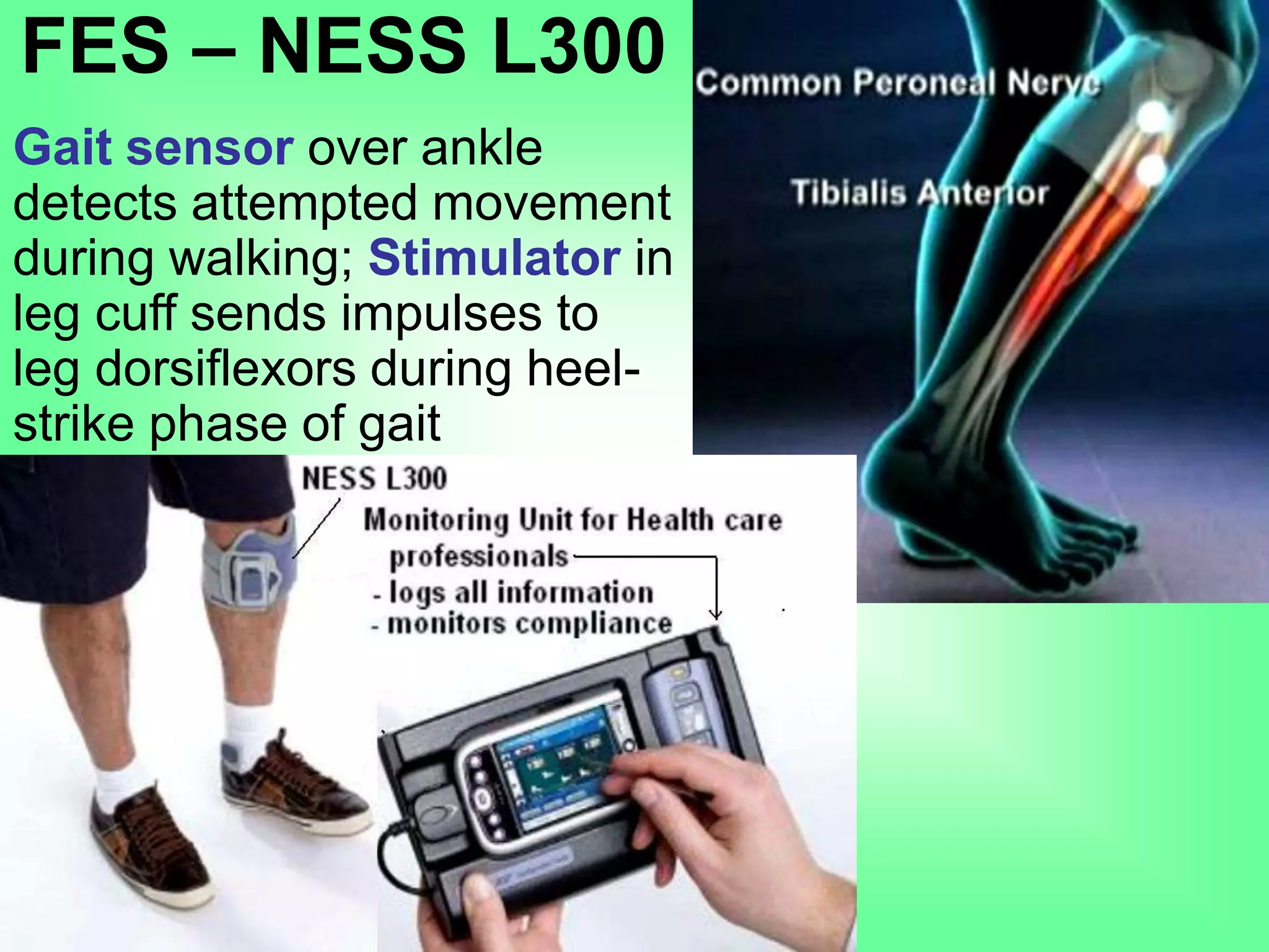 FES – NESS L300
Gait sensor over ankle
detects attempted movement
during walking; Stimulator in
leg cuff sends impulses to
leg dorsiflexors during heel-
strike phase of gait
 