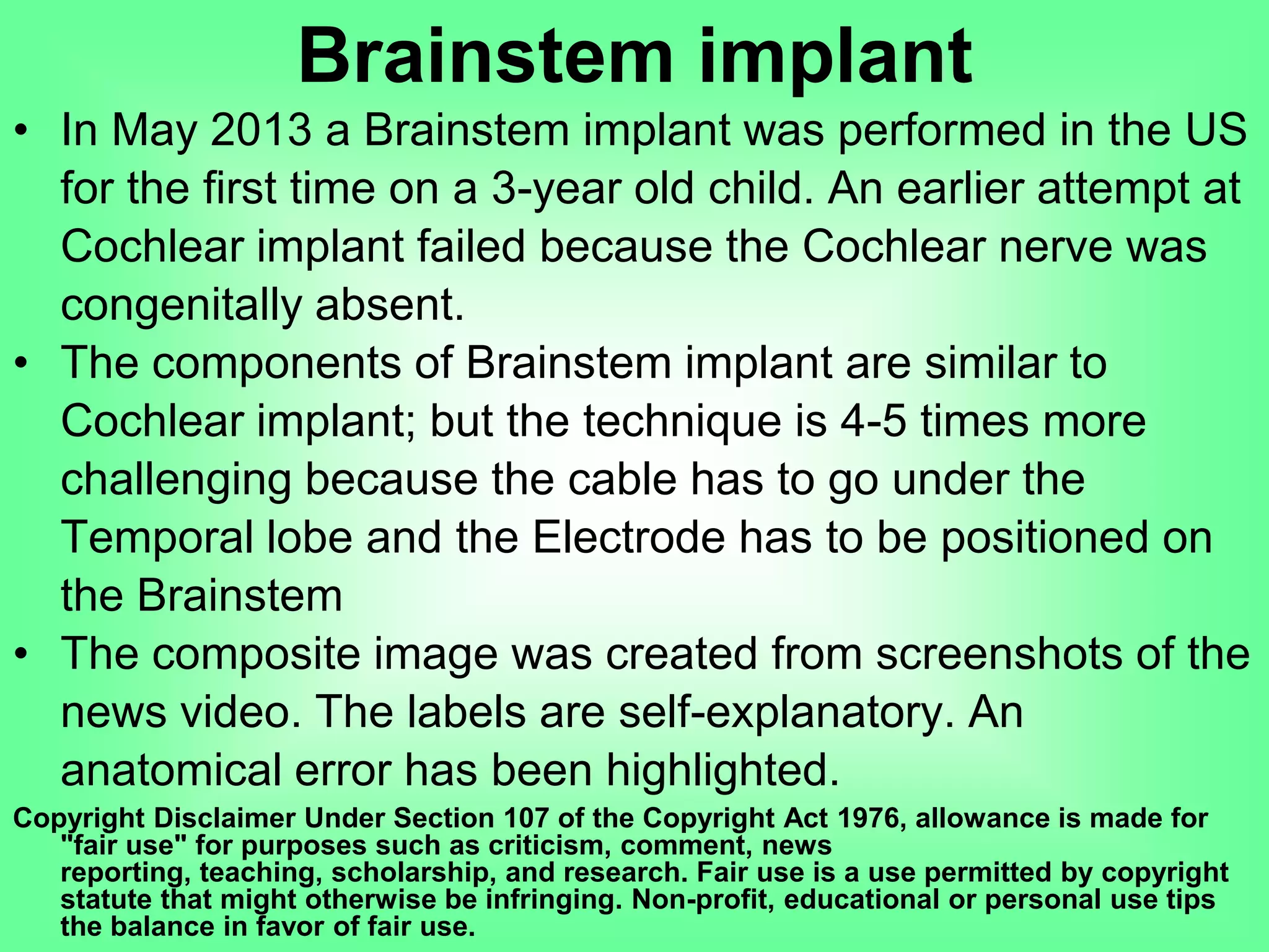 • In May 2013 a Brainstem implant was performed in the US
for the first time on a 3-year old child. An earlier attempt at
Cochlear implant failed because the Cochlear nerve was
congenitally absent.
• The components of Brainstem implant are similar to
Cochlear implant; but the technique is 4-5 times more
challenging because the cable has to go under the
Temporal lobe and the Electrode has to be positioned on
the Brainstem
• The composite image was created from screenshots of the
news video. The labels are self-explanatory. An
anatomical error has been highlighted.
Copyright Disclaimer Under Section 107 of the Copyright Act 1976, allowance is made for
"fair use" for purposes such as criticism, comment, news reporting, teaching,
scholarship, and research. Fair use is a use permitted by copyright statute that might
otherwise be infringing. Non-profit, educational or personal use tips the balance in favor
of fair use.
Brainstem implant
 