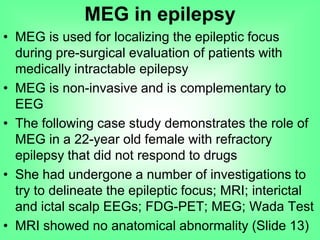 • MEG is used for localizing the epileptic focus
during pre-surgical evaluation of patients with
medically intractable epilepsy
• MEG is non-invasive and is complementary to
EEG
• The following case study demonstrates the role of
MEG in a 22-year old female with refractory
epilepsy that did not respond to drugs
• She had undergone a number of investigations to
try to delineate the epileptic focus; MRI; interictal
and ictal scalp EEGs; FDG-PET; MEG; Wada Test
• MRI showed no anatomical abnormality (Slide 13)
MEG in epilepsy
 