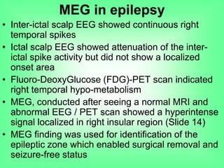 • Inter-ictal scalp EEG showed continuous right
temporal spikes
• Ictal scalp EEG showed attenuation of the inter-
ictal spike activity but did not show a localized
onset area
• Fluoro-DeoxyGlucose (FDG)-PET scan indicated
right temporal hypo-metabolism
• MEG, conducted after seeing a normal MRI and
abnormal EEG / PET scan showed a hyperintense
signal localized in right insular region (Slide 14)
• MEG finding was used for identification of the
epileptic zone which enabled surgical removal and
seizure-free status
MEG in epilepsy
 