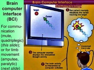 Brain
computer
interface
(BCI)
For commu-
nication
(mute,
quadriplegic)
(this slide);
or for limb
movement
(amputee,
paralytic)
(next slide)
 