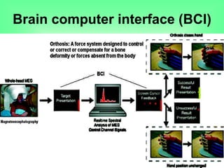 Brain computer interface (BCI)
 
