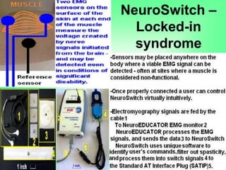 NeuroSwitch –
Locked-in
syndrome
 