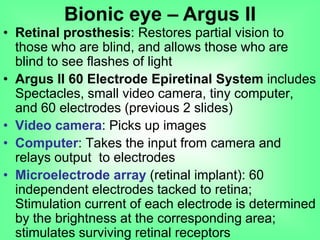 • Retinal prosthesis: Restores partial vision to
those who are blind, and allows those who are
blind to see flashes of light
• Argus II 60 Electrode Epiretinal System includes
Spectacles, small video camera, tiny computer,
and 60 electrodes (previous 2 slides)
• Video camera: Picks up images
• Computer: Takes the input from camera and
relays output to electrodes
• Microelectrode array (retinal implant): 60
independent electrodes tacked to retina;
Stimulation current of each electrode is determined
by the brightness at the corresponding area;
stimulates surviving retinal receptors
Bionic eye – Argus II
 
