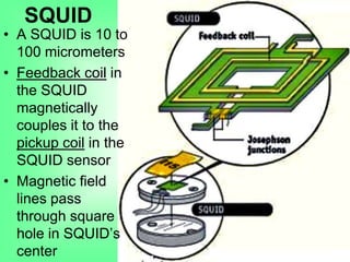 SQUID
• A SQUID is 10 to
100 micrometers
• Feedback coil in
the SQUID
magnetically
couples it to the
pickup coil in the
SQUID sensor
• Magnetic field
lines pass
through square
hole in SQUID‟s
center
 