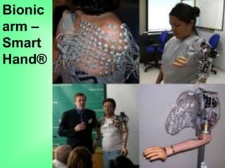 Bionic
arm –
Smart
Hand®
 