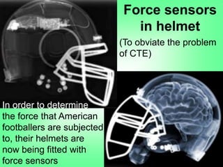 Force sensors
in helmet
In order to determine
the force that American
footballers are subjected
to, their helmets are
now being fitted with
force sensors
(To obviate the problem
of CTE)
 