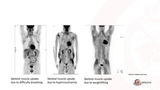 PET CT Variants and Recommendations for Patient Preparation. | PPT