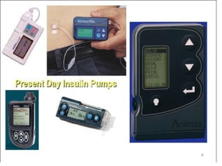 Technology in insulin delivery  systems  future directions.pptx