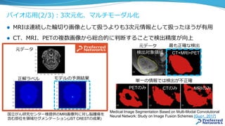 バイオ応⽤(2/3)：3次元化、マルチモーダル化
l  MRIは連続した輪切り画像として扱うよりも3次元情報として扱ったほうが有⽤
l  CT、MRI、PETの複数画像から総合的に判断することで検出精度が向上
Medical Image Segmentation Based on Multi-Modal Convolutional
Neural Network: Study on Image Fusion Schemes [Guo+, 2017]
元データ
国⽴がん研究センター様提供のMRI画像列に対し脳腫瘍を
含む部位を領域セグメンテーション(JST CRESTの成果)
正解ラベル モデルの予測結果
検出対象領域 CT+MRI+PET
最も正確な検出
単⼀の情報では検出が不正確
元データ
PETのみ CTのみ MRIのみ
 