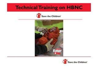 TechnicalTraining on HBNC
 