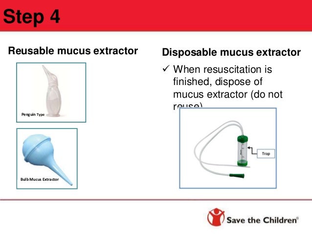 mucus bulb extractor
