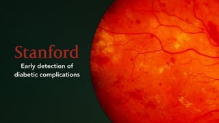 Early detection of 
diabetic complications
 