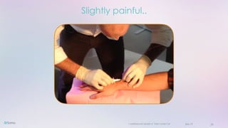 Confidential and copyright of Somo Custom Ltd. June 23 20
Slightly painful..
 