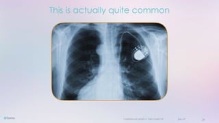 Confidential and copyright of Somo Custom Ltd. June 23 26
This is actually quite common
 