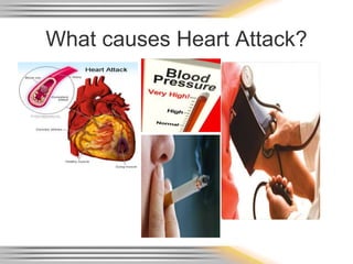 What causes Heart Attack?
 
