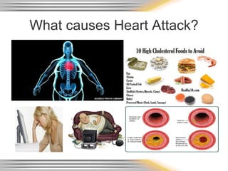 What causes Heart Attack?
 