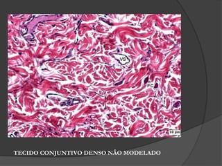 TECIDO CONJUNTIVO DENSO NÃO MODELADO
 