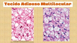 núcleo arredondado e ocupa posição central na célula (seta).
múltiplas gotas de lipídios no citoplasma
 