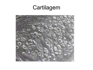 Cartilagem 