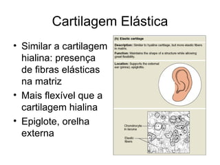 Cartilagem Elástica Similar a cartilagem hialina: presença de fibras elásticas na matriz Mais flexível que a cartilagem hialina Epiglote, orelha externa 