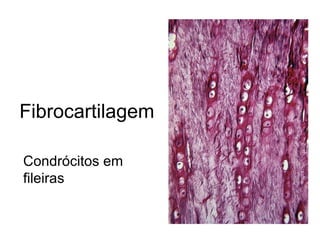 Fibrocartilagem Condrócitos em fileiras 