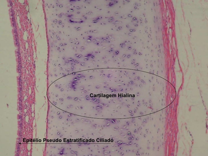 Resultado de imagem para imagem tecido cartilaginoso HIALINA