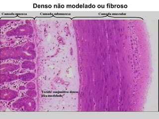 Denso não modelado ou fibroso
 