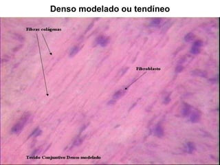 Denso modelado ou tendíneo
 