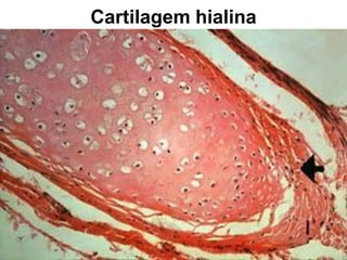 Cartilagem hialina
 