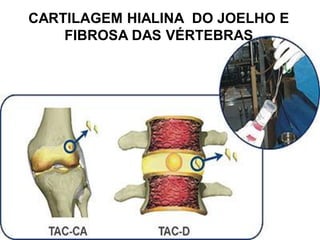 CARTILAGEM HIALINA DO JOELHO E
    FIBROSA DAS VÉRTEBRAS
 