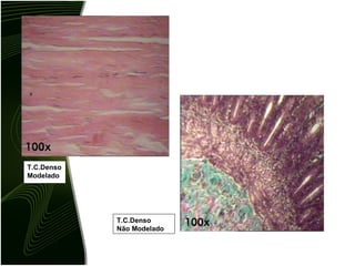 T.C.Denso Modelado T.C.Denso Não Modelado 