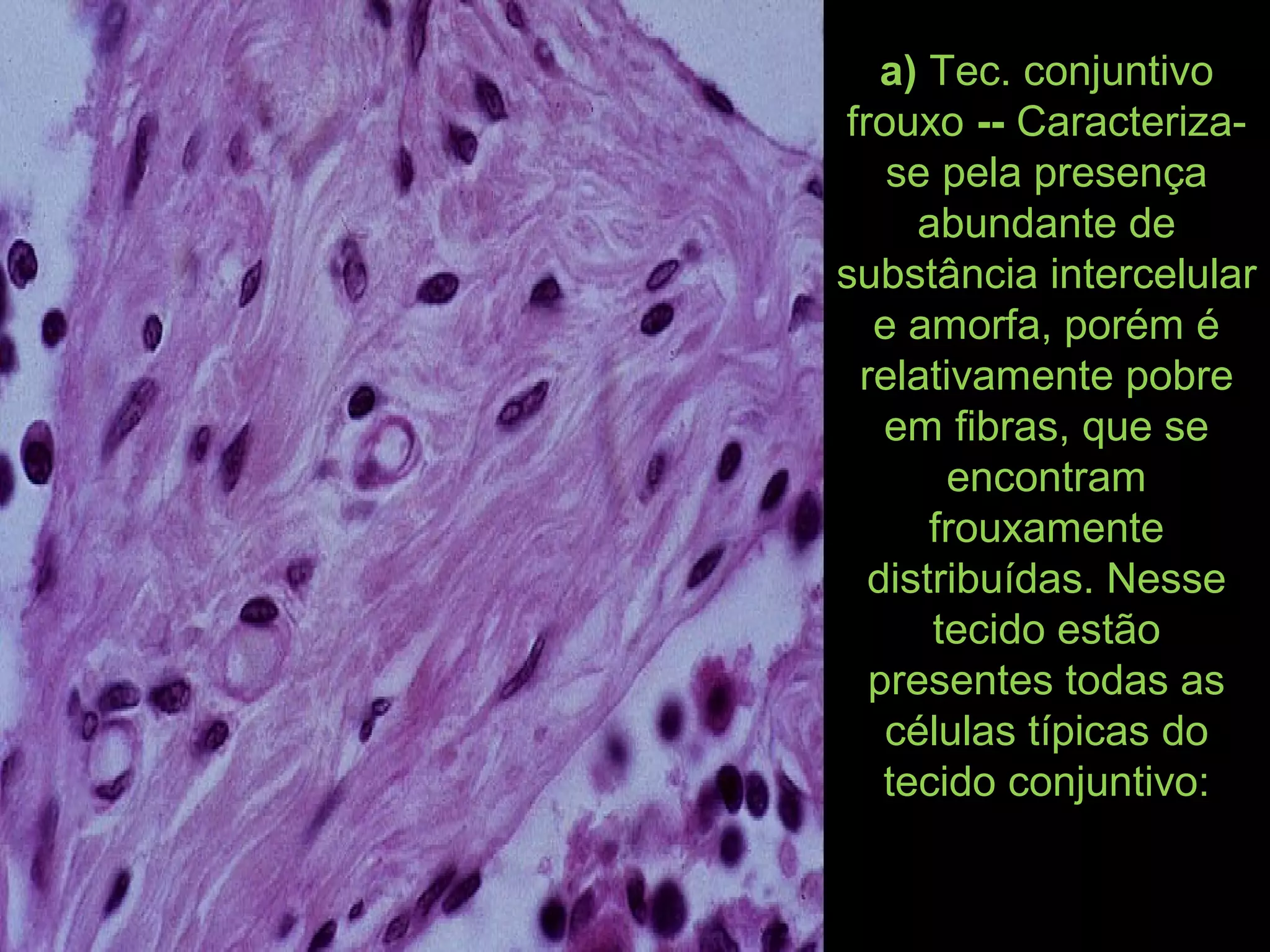 Tecido conjuntivo | PPT