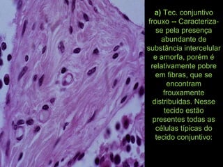 a) Tec. conjuntivo
frouxo -- Caracteriza-
se pela presença
abundante de
substância intercelular
e amorfa, porém é
relativamente pobre
em fibras, que se
encontram
frouxamente
distribuídas. Nesse
tecido estão
presentes todas as
células típicas do
tecido conjuntivo:
 