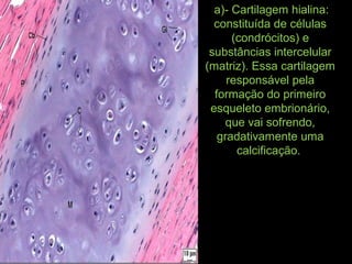 a)- Cartilagem hialina:
constituída de células
(condrócitos) e
substâncias intercelular
(matriz). Essa cartilagem
responsável pela
formação do primeiro
esqueleto embrionário,
que vai sofrendo,
gradativamente uma
calcificação.
 