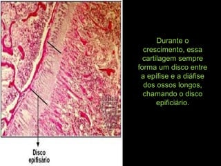 Durante o
crescimento, essa
cartilagem sempre
forma um disco entre
a epífise e a diáfise
dos ossos longos,
chamando o disco
epificiário.
 
