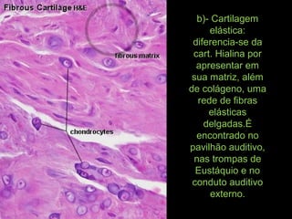 b)- Cartilagem
elástica:
diferencia-se da
cart. Hialina por
apresentar em
sua matriz, além
de colágeno, uma
rede de fibras
elásticas
delgadas.É
encontrado no
pavilhão auditivo,
nas trompas de
Eustáquio e no
conduto auditivo
externo.
 