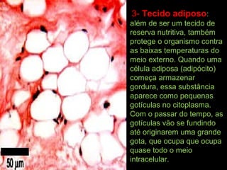 3- Tecido adiposo:
além de ser um tecido de
reserva nutritiva, também
protege o organismo contra
as baixas temperaturas do
meio externo. Quando uma
célula adiposa (adipócito)
começa armazenar
gordura, essa substância
aparece como pequenas
gotículas no citoplasma.
Com o passar do tempo, as
gotículas vão se fundindo
até originarem uma grande
gota, que ocupa que ocupa
quase todo o meio
intracelular.
 