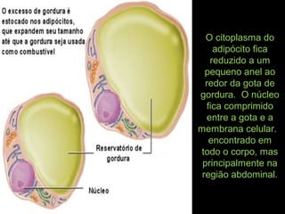 O citoplasma do
adipócito fica
reduzido a um
pequeno anel ao
redor da gota de
gordura. O núcleo
fica comprimido
entre a gota e a
membrana celular.
encontrado em
todo o corpo, mas
principalmente na
região abdominal.
 