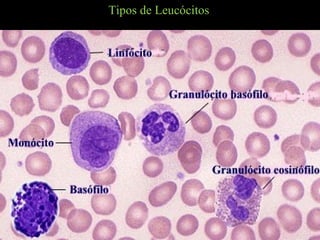 Tipos de Leucócitos
 