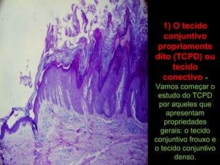 1) O tecido
conjuntivo
propriamente
dito (TCPD) ou
tecido
conectivo -
Vamos começar o
estudo do TCPD
por aqueles que
apresentam
propriedades
gerais: o tecido
conjuntivo frouxo e
o tecido conjuntivo
denso.
 