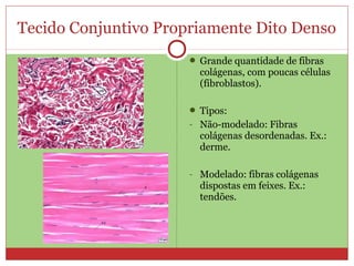 Tecido Conjuntivo Propriamente Dito Denso
 Grande quantidade de fibras
colágenas, com poucas células
(fibroblastos).
 Tipos:
- Não-modelado: Fibras
colágenas desordenadas. Ex.:
derme.
- Modelado: fibras colágenas
dispostas em feixes. Ex.:
tendões.
 