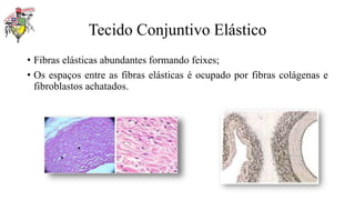 Tecido Conjuntivo Elástico
• Fibras elásticas abundantes formando feixes;
• Os espaços entre as fibras elásticas é ocupado por fibras colágenas e
fibroblastos achatados.
 