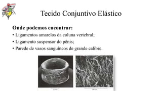 Tecido Conjuntivo Elástico
Onde podemos encontrar:
• Ligamentos amarelos da coluna vertebral;
• Ligamento suspensor do pênis;
• Parede de vasos sanguíneos de grande calibre.
 