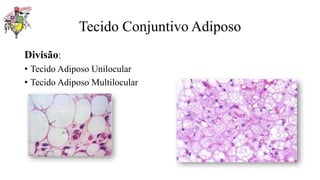 Tecido Conjuntivo Adiposo
Divisão:
• Tecido Adiposo Unilocular
• Tecido Adiposo Multilocular
 