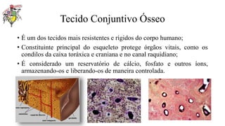 Tecido Conjuntivo Ósseo
• É um dos tecidos mais resistentes e rígidos do corpo humano;
• Constituinte principal do esqueleto protege órgãos vitais, como os
condilos da caixa toráxica e craniana e no canal raquidiano;
• É considerado um reservatório de cálcio, fosfato e outros íons,
armazenando-os e liberando-os de maneira controlada.
 