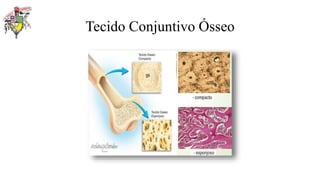 Tecido Conjuntivo Ósseo
 
